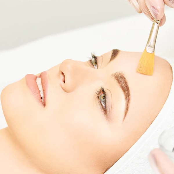 Lactic Peel, Lactic Refining Facial, less lines and reduced pigmentation